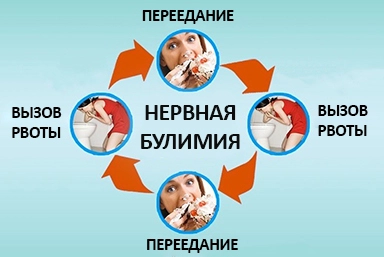 Лечение булимии в Дегтярске